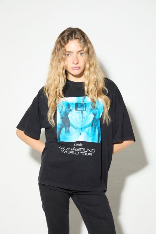 REMERA ULTRASOUND